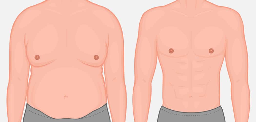 How long does top surgery take | A Comprehensive Guide (2025)